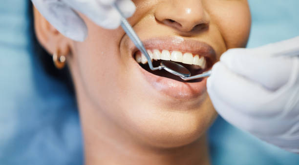 Best Knocked-Out Tooth Emergency  in Moses Lake, WA
